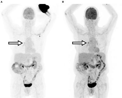 The Scientific and Clinical Case for Reviewing Diagnostic Radiopharmaceutical Extravasation Long-Standing Assumptions